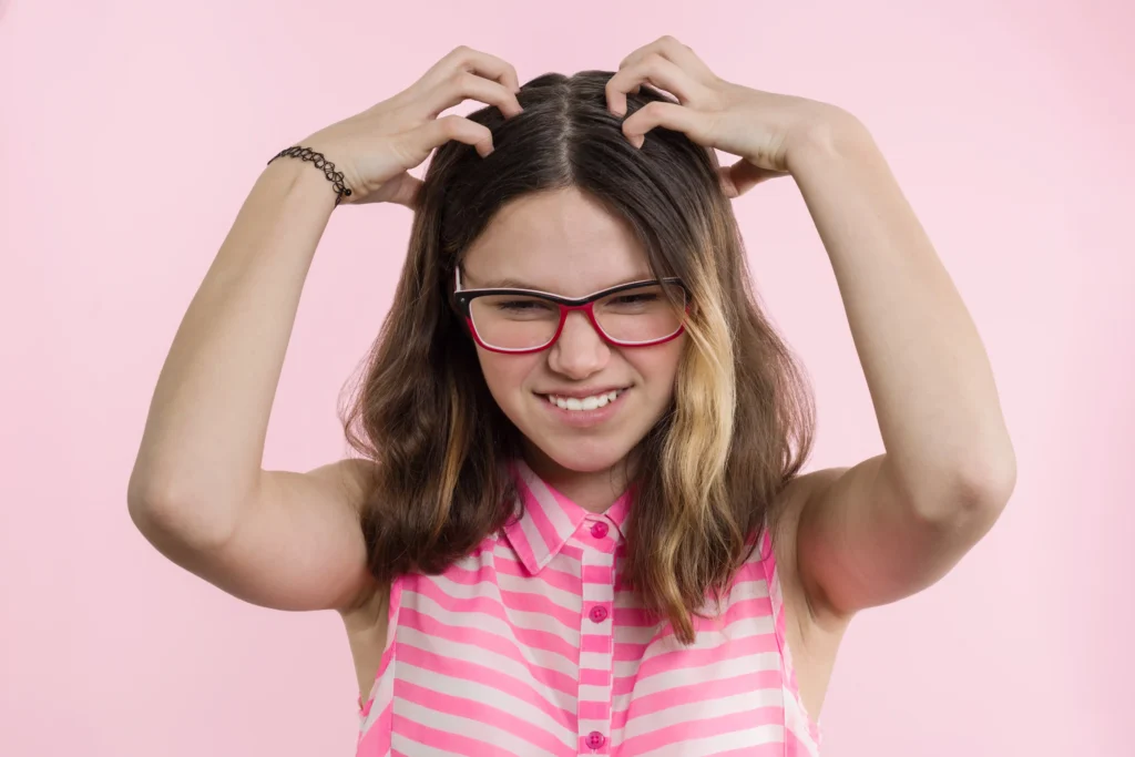 symptoms of dandruff lice