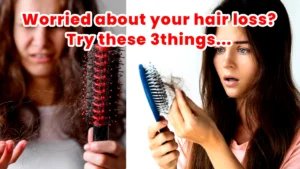 Worried-about-your-hair-loss-Try-these-3things